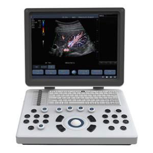 Portable Color Doppler Ultrasound Scanner BENE-3S 2