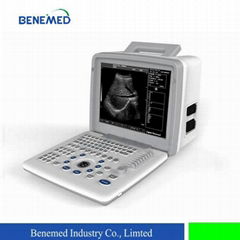 Portable B/W Ultrasound Scanner with Clear Image Quality