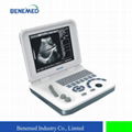 BW-6 Notebook LED Ultrasound Diagnostic