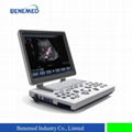 Portable Color Doppler Ultrasound Scanner BENE-3S