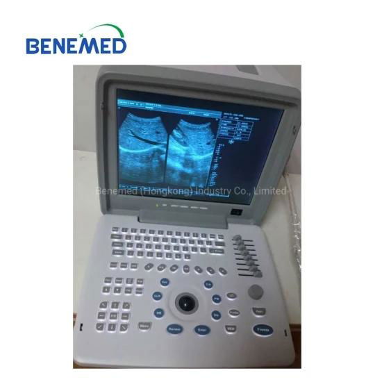 Portable B/W Ultrasound Scanner with Clear Image Quality 3