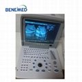 Portable B/W Ultrasound Scanner with Clear Image Quality 3