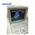 Portable B/W Ultrasound Scanner with Clear Image Quality 4