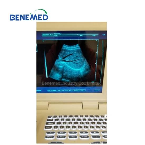 BW-6 Notebook LED Ultrasound Diagnostic Scanner 2