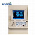 BW-6 Notebook LED Ultrasound Diagnostic Scanner 3