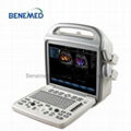 Popular portable Color doppler Ultrasound scanner 4