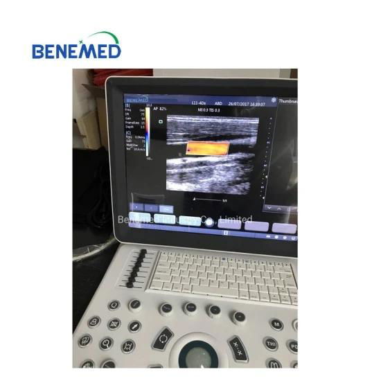 Portable Color Doppler Ultrasound Scanner BENE-3S 5