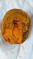 OX Gallstone 1