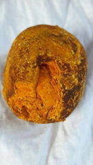 OX Gallstone