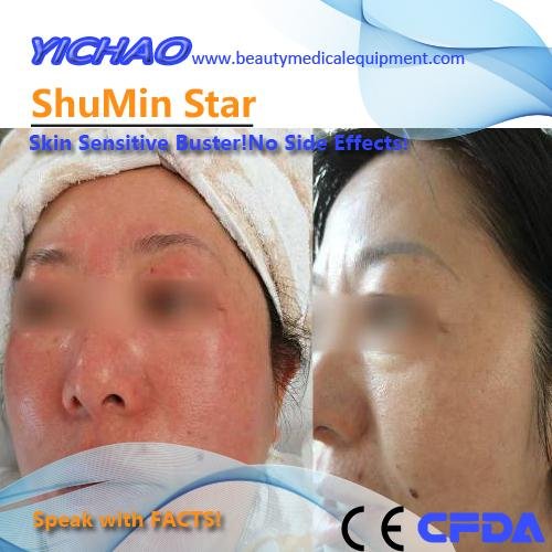 Multifunctional Medical Beauty Device for Face to Rebuild Skin Barrier 5