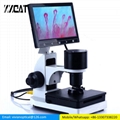 USB Digital Microscope Blood Microcirculation Zoom Nailfold Capillary  1