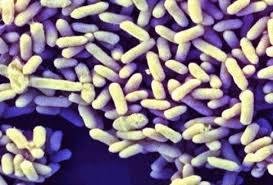 Probiotics Bifidobacterium  infantis