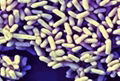 Probiotics Bifidobacterium  infantis