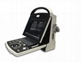 Meditech Ultrasound Scanner with PC Platform 3