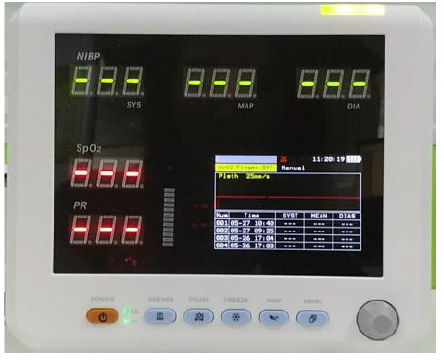 Oxima3 Vital Signs Monitor Three Parameters: NIBP SpO2 and Pulse Rate Ce Approve 4