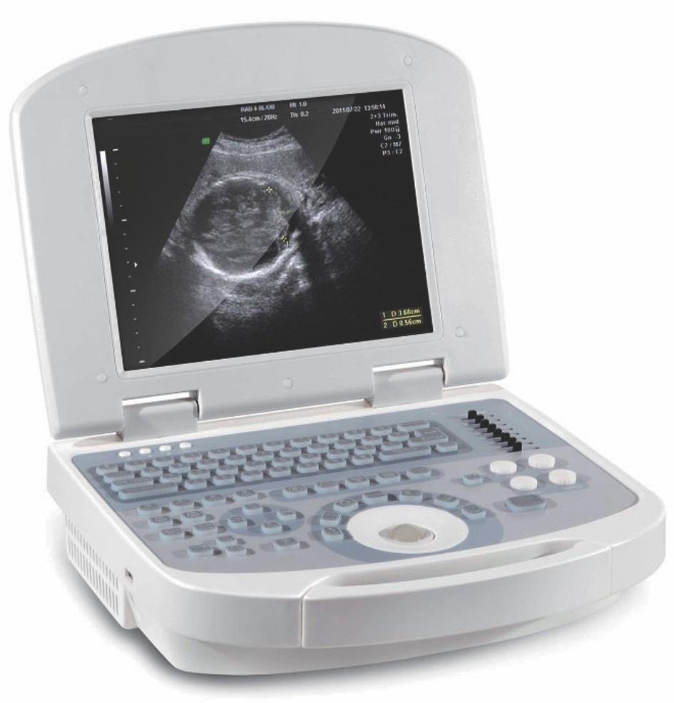 Dolphi PRO Convex Probe Standard B/W Ultrasound Scanner Ce & ISO Approved 2