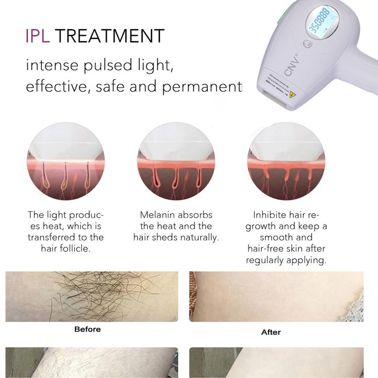 CNV Permanent Hair Removal WPL ICE Cool 350,000 Flashes Light Painless IPL Hair  5