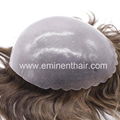 Full Skin Soft Stock Hair Replacement 1