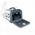 10.1 inch full digital Pseudo color ultrasound scanner 1