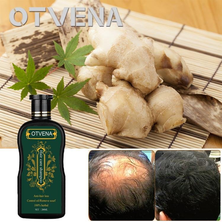 OTVENA Shampoo for hair growth and anti hair loss 5