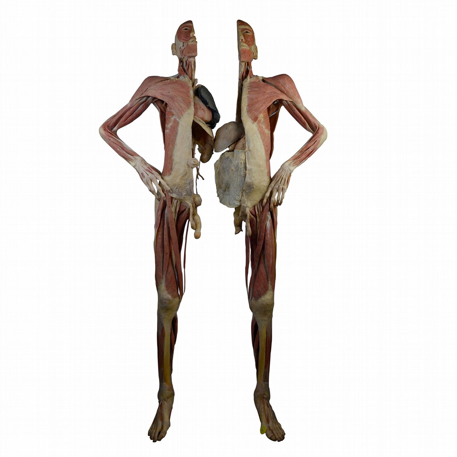 Human Decomposer Body Plastination for Plastination Museum and Exhibit