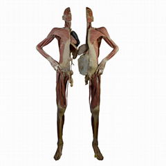 Human Decomposer Body Plastination for Plastination Museum and Exhibit