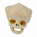 Fontanelle of Infant Plastination Human Specimen for Teaching Anatomy 1