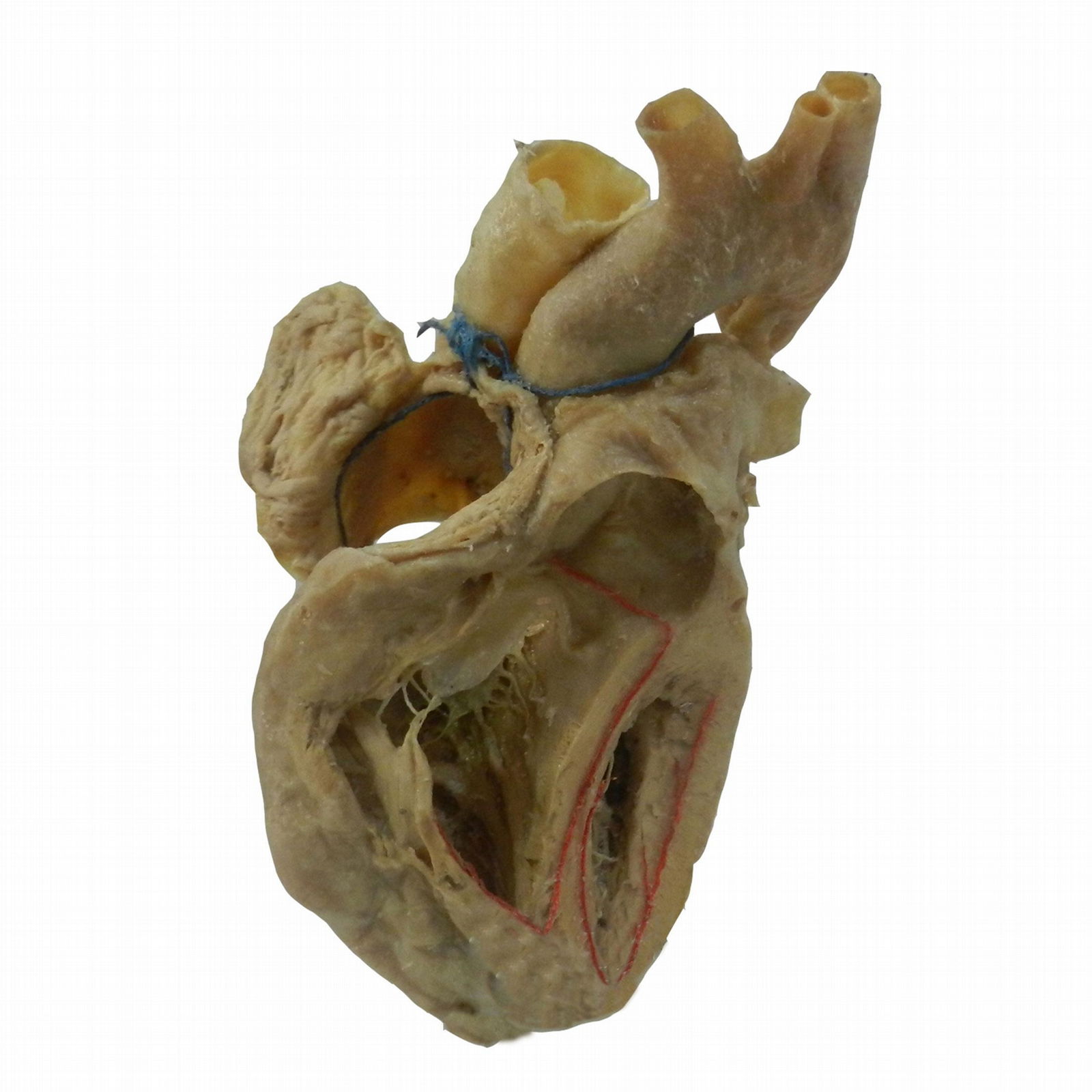 Conduction System of Human Heart Plastination Specimen