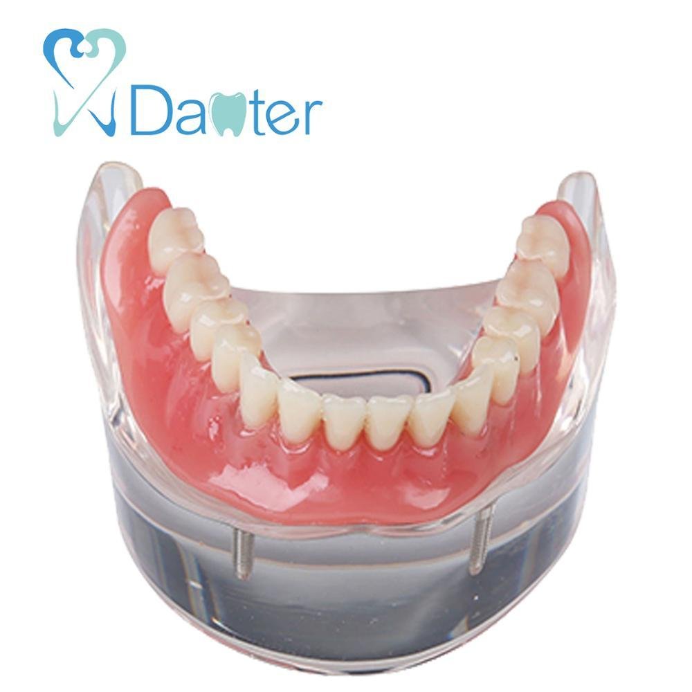 Danter 2 implants restoration sillones dental model implant dental tool for trai