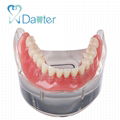 Danter 2 implants restoration sillones dental model implant dental tool for trai