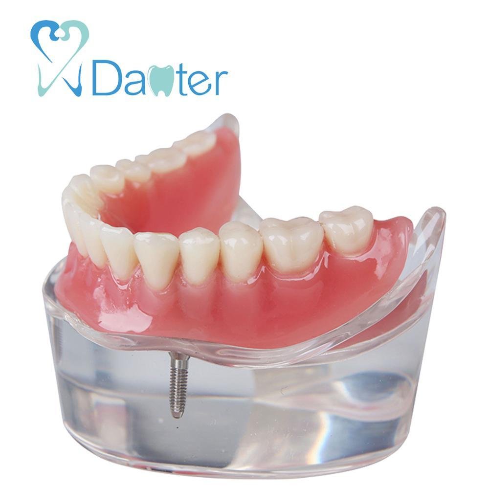 Danter 2 implants restoration sillones dental model implant dental tool for trai 2