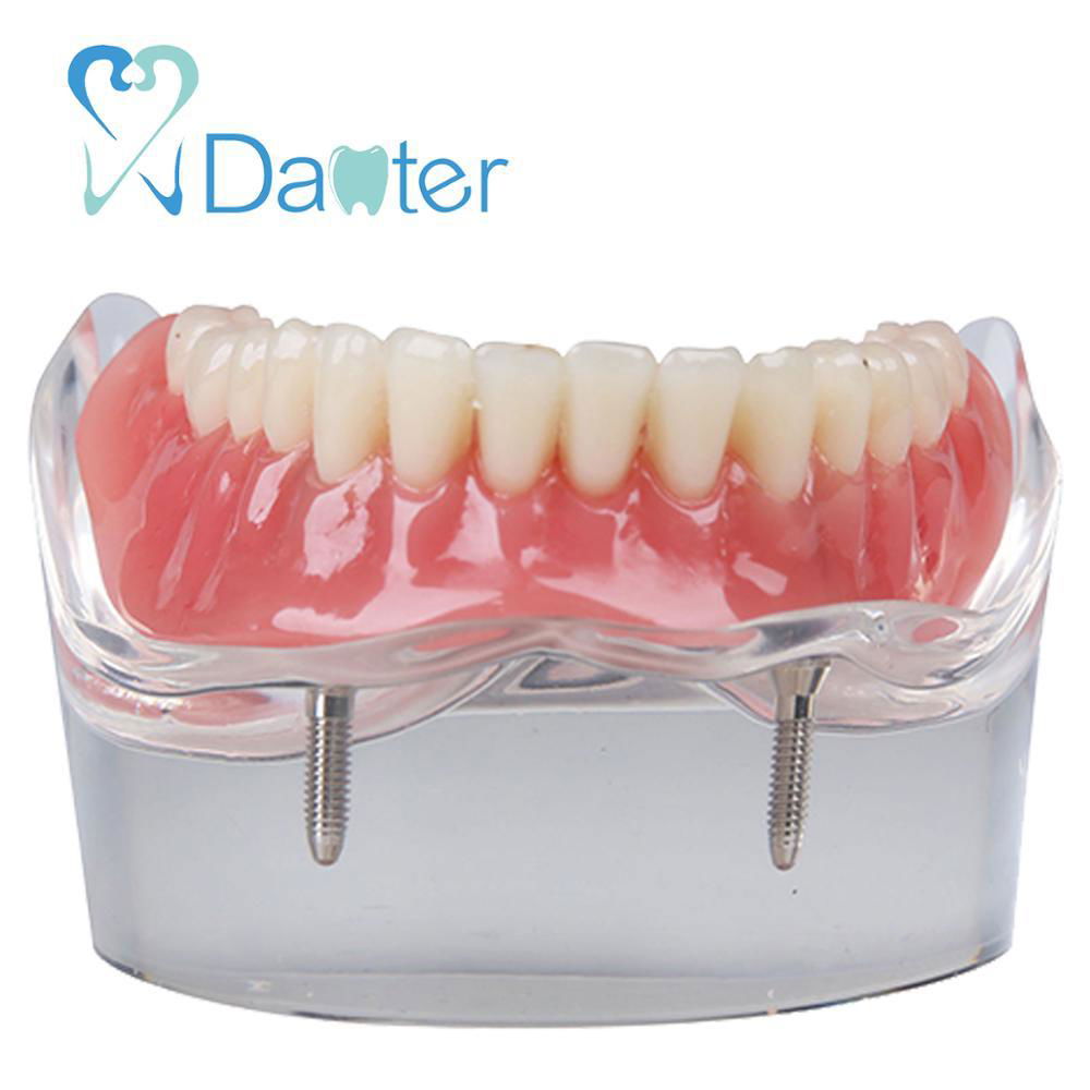 Danter 2 implants restoration sillones dental model implant dental tool for trai 3