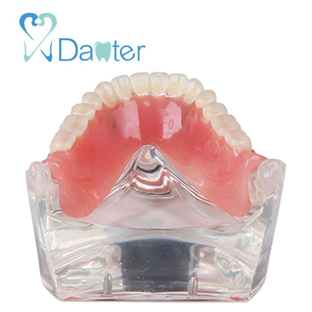 Danter 2 implants restoration sillones dental model implant dental tool for trai 4