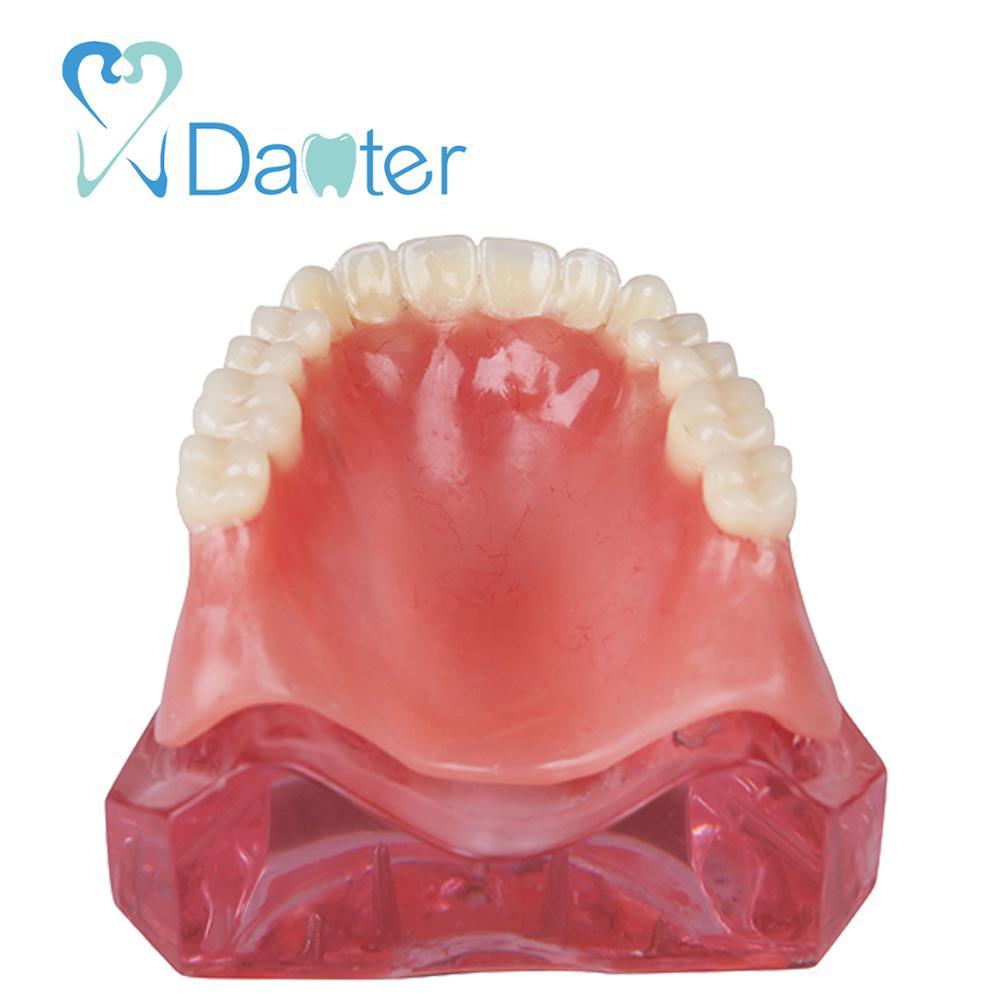 High quality teeth study dental implant restoration model interior maxillary 2