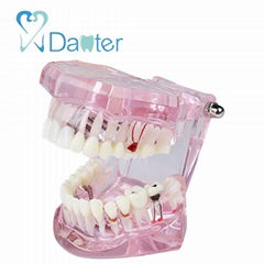 Colorful teeth study model dental model