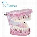 Colorful teeth study model dental model implant dental unit for sales 2