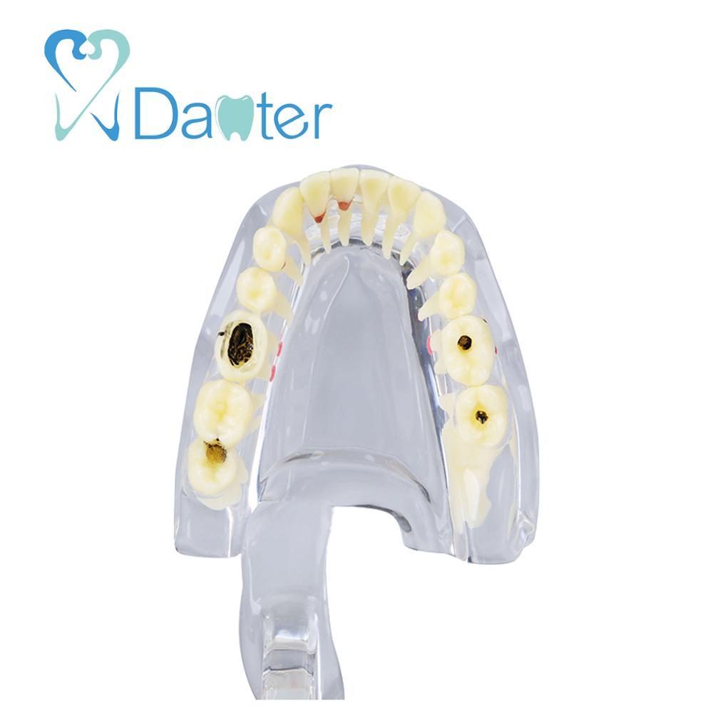 Colorful teeth study model dental model implant dental unit for sales 4