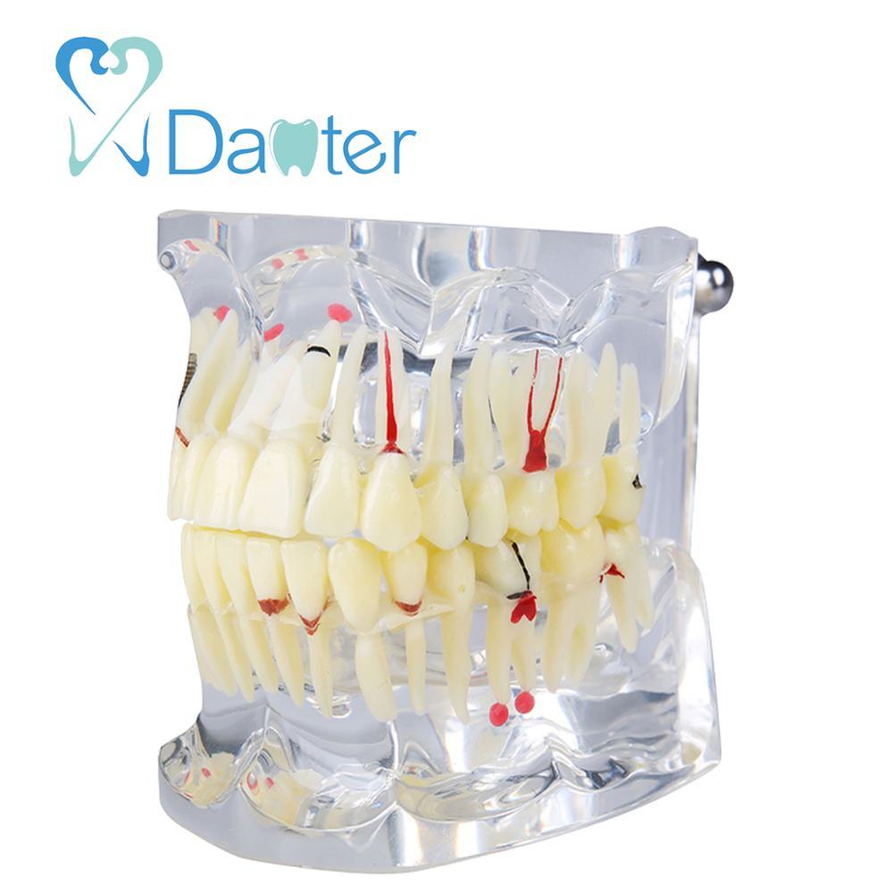 Colorful teeth study model dental model implant dental unit for sales 5