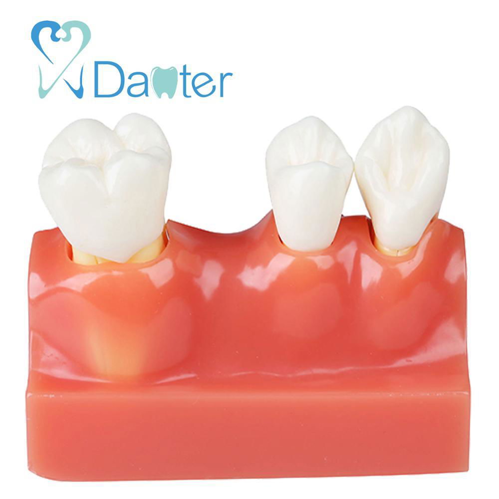 High quality teaching human oral model dental unit dental product for dentist