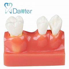 High quality teaching human oral model dental unit dental product for dentist