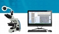 QB-200A Laptop Sperm Quality Analyzer 3