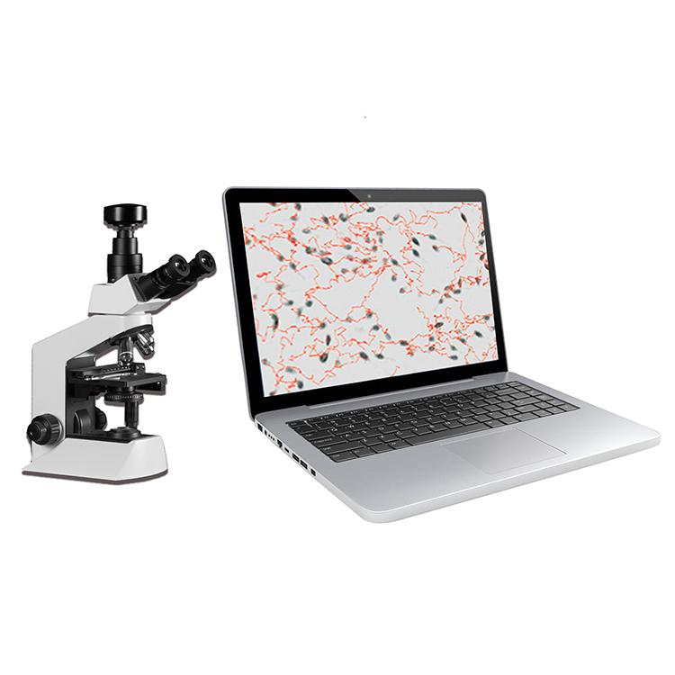 QB-200A Portable computer aided sperm analysis 3