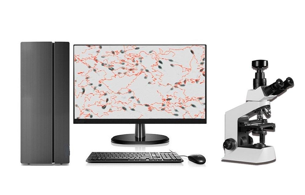 QB-200A Portable computer aided sperm analysis