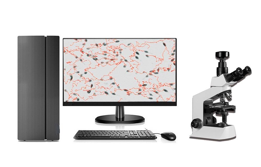 QB-300 Fully Automated Sperm Analyzer with advanced microscope 4