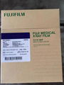 Original Fujifilm  Medical X-ray Imaging Film 8x10,10x12,10x14,14x17'' Film