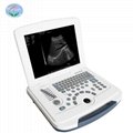 Digital high quality portable ultrasound scanner 
