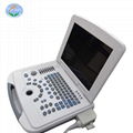 Laptop ultrasound Diagnosis System