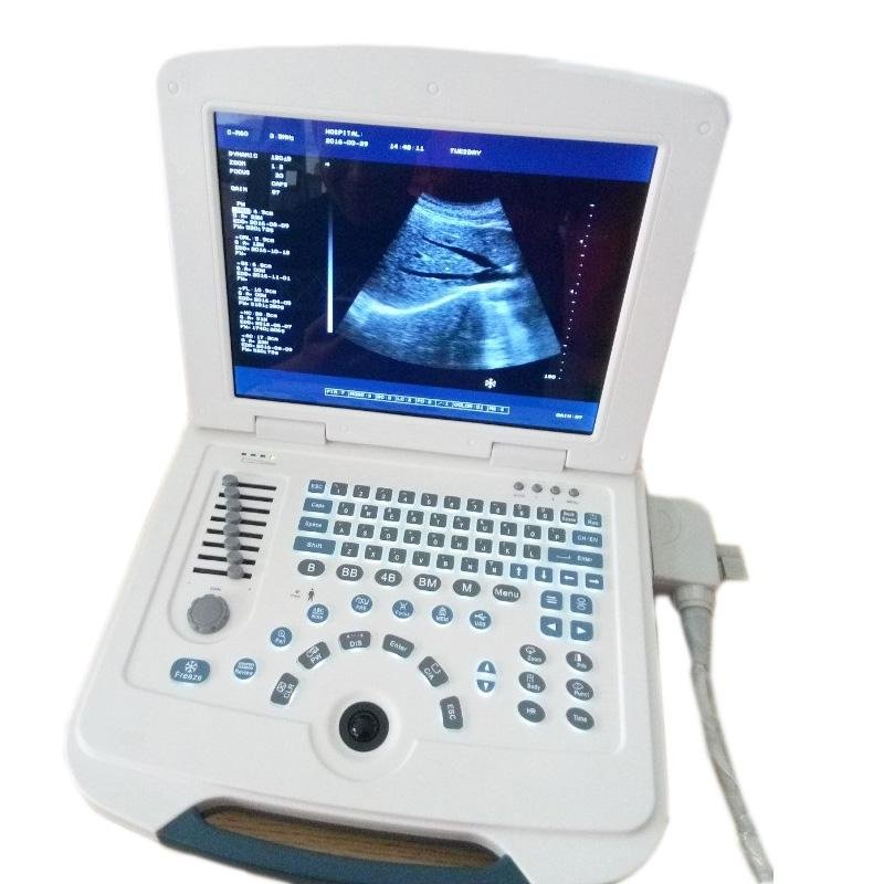 Laptop ultrasound Diagnosis System Medical 2
