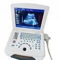 Laptop ultrasound Diagnosis System Medical 2