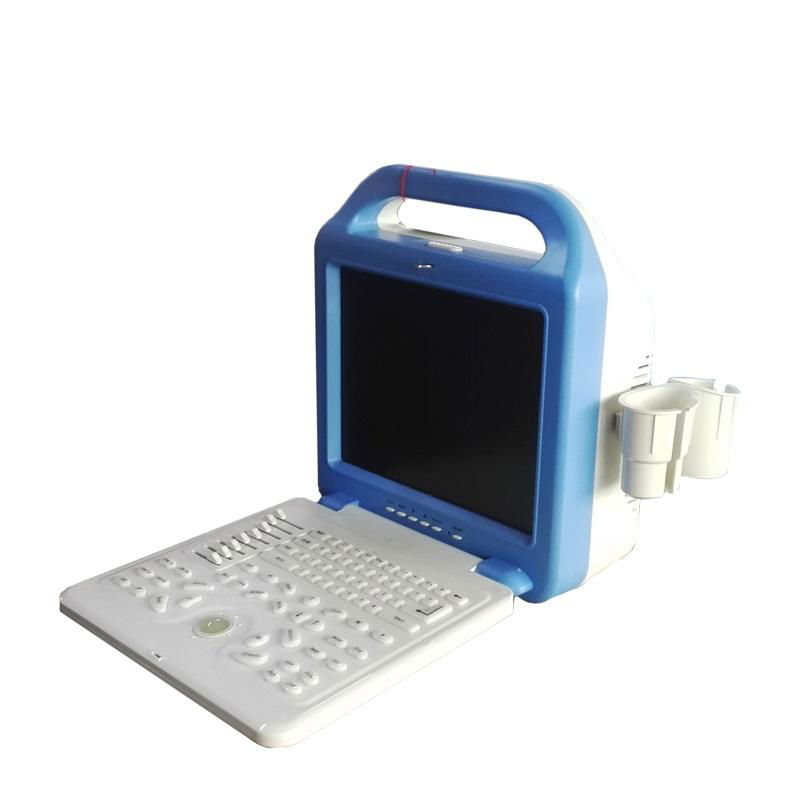 Digital ultrasound machine trolley ultrasonic diagnostic equipment  2